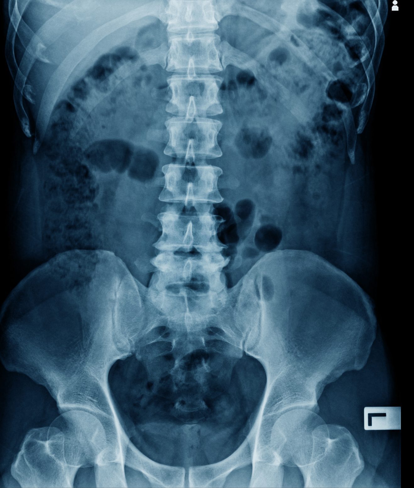 Do Chiropractors Always Take X-Rays? Here’s What You Need to Know